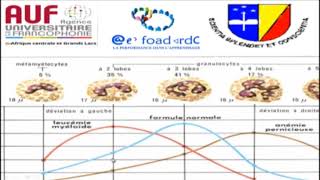 MORPHOLOGIE EN HEMATOLOGIE EPISODE 11 [upl. by Dagley830]