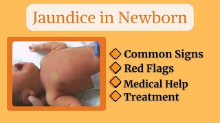 “Why Do Newborns Turn Yellow Understanding Jaundice in Babies” baby newborn newparentsguide [upl. by Aivatnahs430]