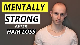 Hair Loss and Confidence Message For Young MEN [upl. by Tye815]