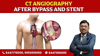 Ct angiography after Bypass and Stent  Dr Bimal Chhajer  Saaol [upl. by Fransis]