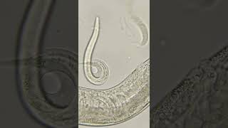 Phylum Aschelminthes Nematoda Roundworms [upl. by Nylecoj]