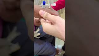 Iv cannula kaise lagate hain  live Demo of iv cannulation procedure cannula Insertion technique [upl. by Burny584]