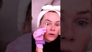 Applying TCA to eyelid tighteningskin [upl. by Mamie499]