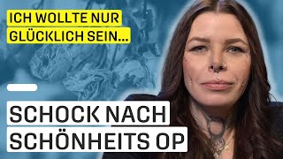 „Ich fühlte mich hässlich“  Glück durch SchönheitsOPs [upl. by Snashall918]