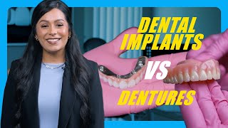 Dental Implants vs Dentures [upl. by Onofredo132]