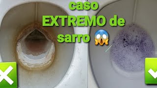 Como limpiar baño lleno de SARRO [upl. by Nairadal]