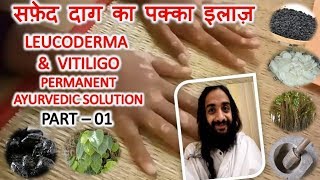 सफ़ेद दाग का पक्का इलाज़1 LEUCODERMA AND VITILIGO PERMANENT AYURVEDIC SOLUTION  PART  01 [upl. by Akenihs]