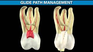 ProTaper Gold  Shaping the Future of Endodontics  Dentsply Sirona [upl. by Sprague863]