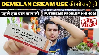 demelan cream review  demelan cream best pigmentation cream  how to remove pigmentation amp darkspot [upl. by Kraft]