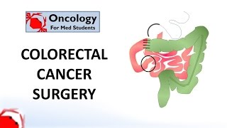 Colorectal Cancer Surgery principles and types [upl. by Hardunn]