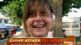 Family Says Chimp Attack Victim Talking Moving [upl. by Roberto13]