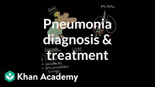 Pneumonia diagnosis and treatment  Respiratory system diseases  NCLEXRN  Khan Academy [upl. by Noitsuj230]