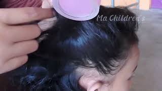 ASMR Lice and Nits Removal for Ultimate Scalp Check  Satisfying [upl. by Norrahs724]