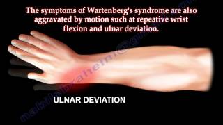 Entrapment of Radial Nerve Wartenbergs Syndrome  Everything You Need To Know  Dr Nabil Ebraheim [upl. by Okimat]