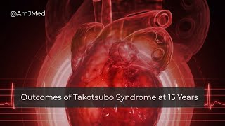 How Is Takotsubo Syndrome Different from a Myocardial Infarction [upl. by Beebe353]