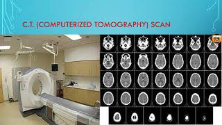 CT  computerized tomography Scan  in hindi [upl. by Euqinue]