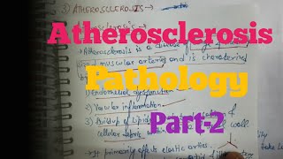 Atherosclerosis Part  2 Pathology [upl. by Asek]