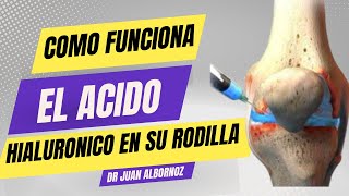 QUÉ HACE EL ÁCIDO HIALURÓNICO EN SU RODILLA doctorjuancarlosalbornoz artrosisderodilla [upl. by Eidod]