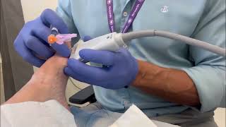 Sesamoid injection for osteoarthritis [upl. by Asselem]