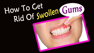 How Treat Swollen Gums Naturally at Home  Home Remedies for Gums Swelling [upl. by Aushoj]