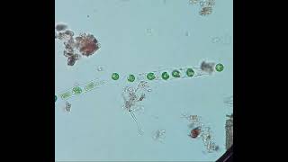 Microspora cells becoming flagellated Zoospores  real time [upl. by Andria]