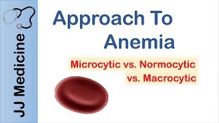 Anemia  Microcytic vs Normocytic vs Macrocytic [upl. by Wilie]