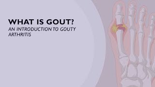 What is Gout An Introduction to Gouty Arthritis 1 of 6 [upl. by Lonni]