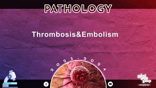 Revision of L 14 Thrombosis and embolism pathology [upl. by Brigette429]