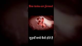 जुड़वाँ बच्चे कैसे होते हैhow twins are formedbaby pregnancy [upl. by Atiuqin]