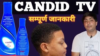 candid tv shampoo  candid tv suspension  candid tv suspension uses in hindi  candid tv [upl. by Nylrad]