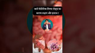 mesenteric lymph nodes meaning in hindi mln lymphnodes lymph node treatment [upl. by Faso]