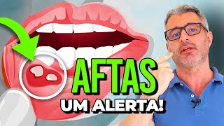 O que significa ter AFTAS e como evitálas 🔴 [upl. by Safier124]