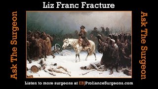 Lisfranc Fracture An Orthopedic Surgeons Experience [upl. by Rodd]