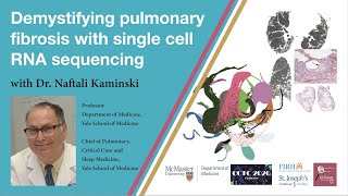 Demystifying pulmonary fibrosis with single cell RNA sequencing [upl. by Nibram]