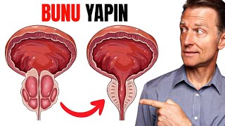 Büyümüş Prostatı Küçülten TEK YİYECEK  Dr Berg Türkçe [upl. by Esdnil]