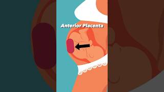 Anterior Placenta and Baby Kicks pregnancy [upl. by Imray208]