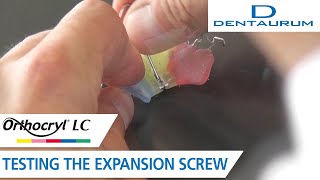 Orthocryl® LC – testing the expansion screw orthodontic appliance [upl. by Thrift403]