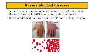 Haematological diseases  BPharm SEM II Pathophysiology by Manjushree Pawar [upl. by Kancler61]