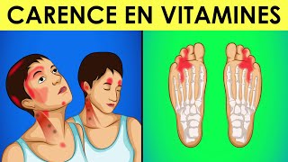 Symptômes dune CARENCE en Vitamine B12  Ne les Ignorez Pas [upl. by Cleo]