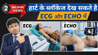 Can ECG and echocardiogram detect heart blockageMust Know facts [upl. by Particia517]