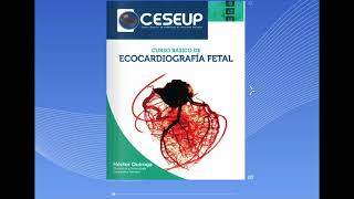 Manual de ecocardiografía fetal Pronto a la venta [upl. by Velda953]