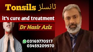 Tonsillitis and its treatment Homeopathic DrNasir Aziz Consult us before operation [upl. by Benedetta]