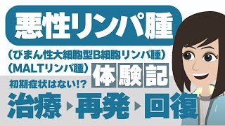 【悪性リンパ腫（MALTリンパ腫・びまん性大細胞型B細胞リンパ腫）】自覚症状はなかった…！？ [upl. by Bozovich]