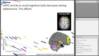 Adolescence and Learning  The Teenage Brain  Juliet Starbuck [upl. by Hilleary727]