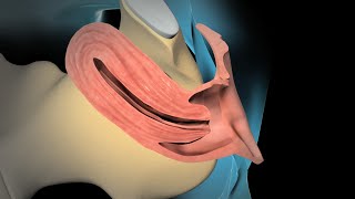 Dilation and Curettage D amp C [upl. by Attemaj]