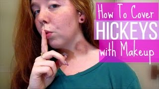 How To Cover Hickeys with Makeup  Lets Talk [upl. by Nathanson450]