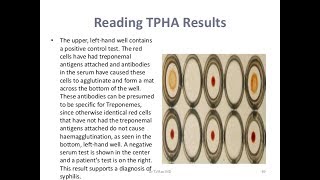 TPHA TestPositive [upl. by Hgieloj]