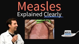 Measles rubeola Explained Clearly by MedCramcom [upl. by Anujra]