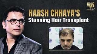 Harsh Chhaya’s Stunning Hair Transplant  Celebrity Hair Goals  MedLink [upl. by Eannyl]