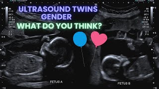 Ultrasound Pregnancy Twins Gender Identification Special interaction between the twins ❤️ [upl. by Iclek]